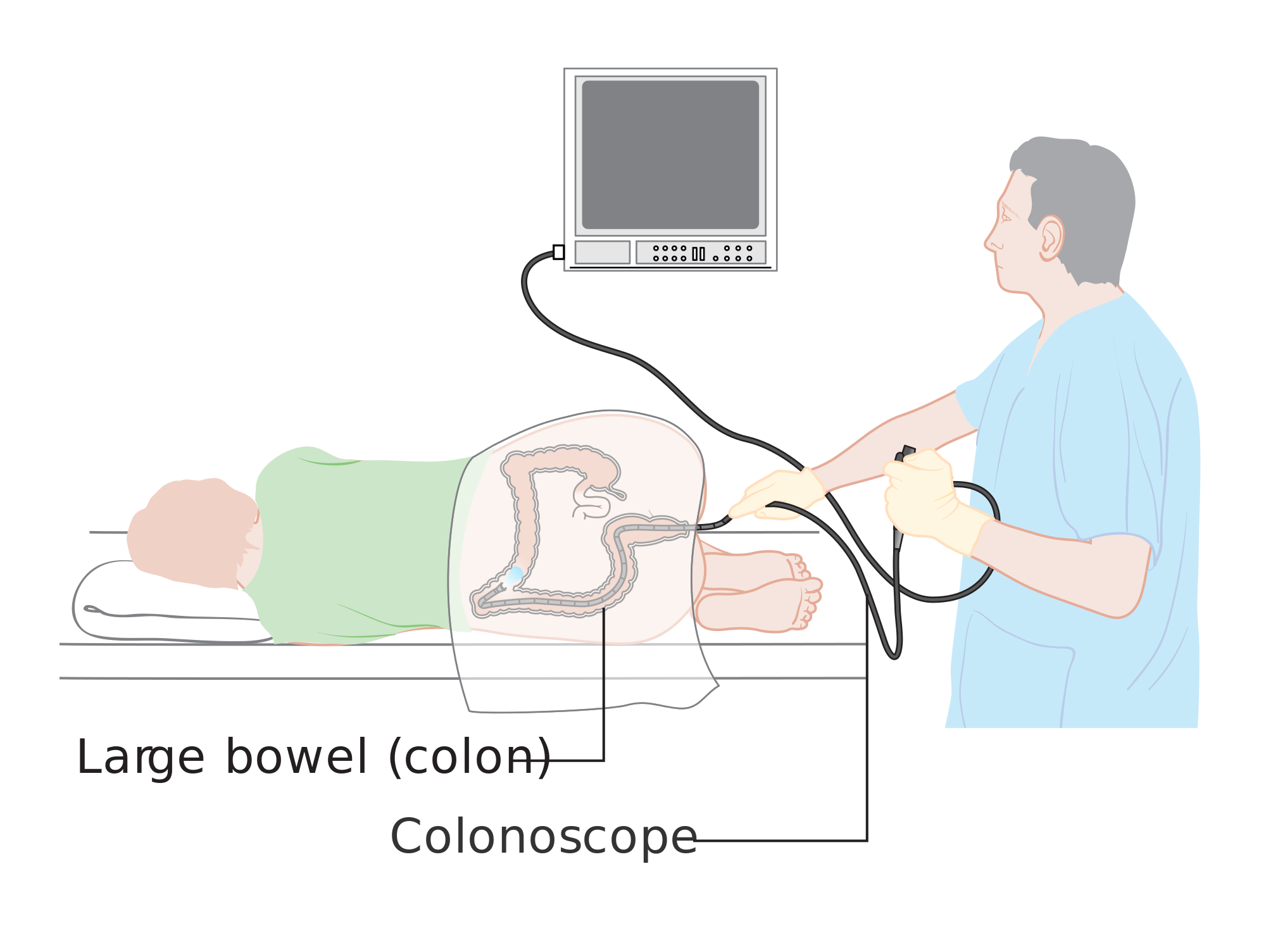 colonoscopy