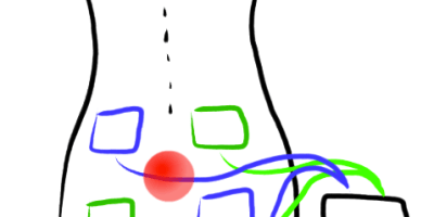 How did Ye Olde Blogge use a TENS Unit to get through the Insurrection and Cambodian Genocide anniversaries?