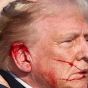 A close up of Trump's right side in five-quarters profile (both eyes visible). It shows two streams of blood having fun across his cheek to his mouth. It shows the upper part of his pinna bleeding with what seem to be two locus of damage to the front and back of the helix. There does not appear to be any extreme damage. It seems cut at best.